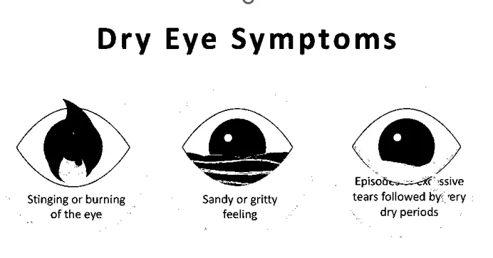 What is Dry Eye and what are its symptoms and treatments? 3 dry eye