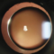 Microspherophakia 10 Microspherophakia