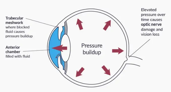 Pressure behind left eye