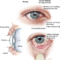 3 types of conjunctivitis