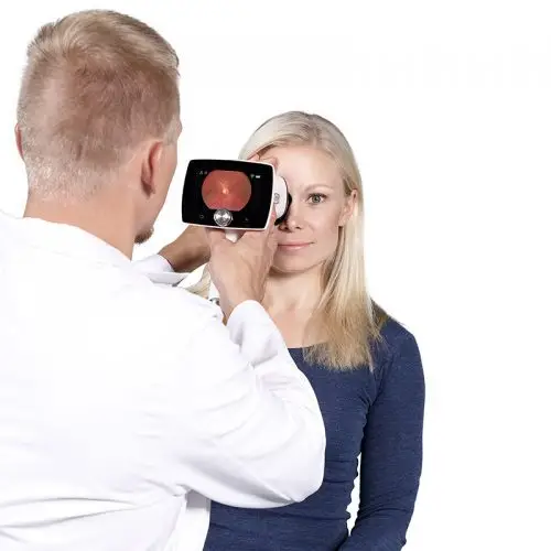 handheld fundus camera