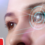 evo icl an alternative to LASIK