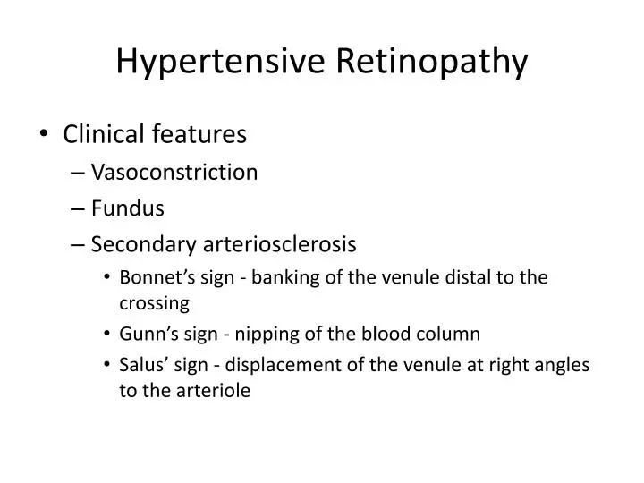 Gunn's sign and salus sign in Hypertensive retinopathy.