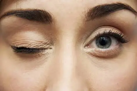 What is Ocular myokymia
