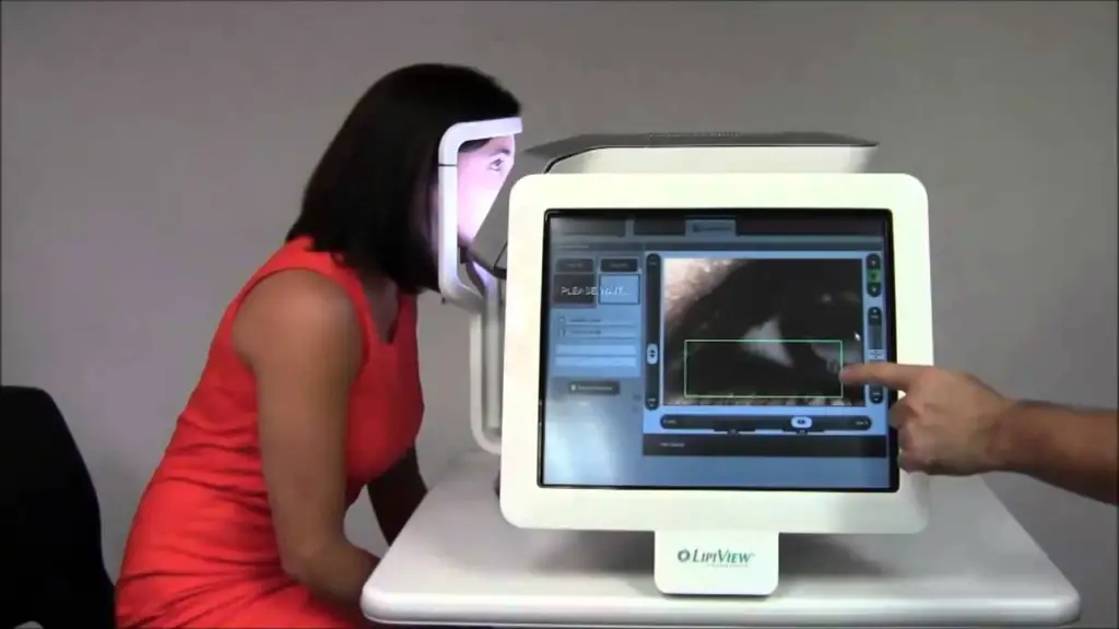 What is Meibography and how is it evaluated? 5 image 52