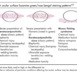 Ocular surface fluorescein staining 10 ocular surface fluorescein staining