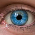 Types of Punctal Plugs