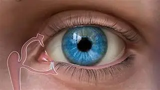 Types of Punctal eye Plugs 