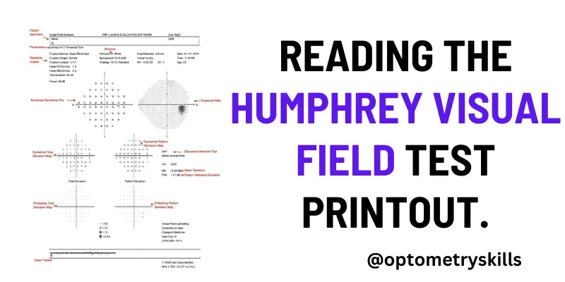 Reading the Humphrey visual field test printout.