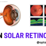 solar retinopathy