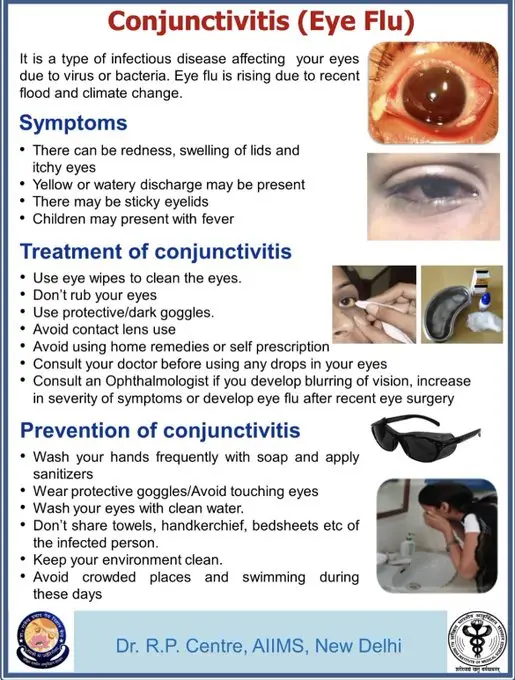 Eye Flu Cases 