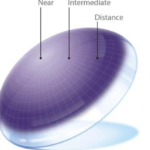 Types of contact lenses for presbyopia