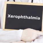 xeropthalmia