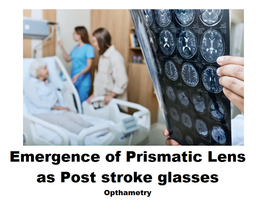 Prismatic Lens as Post stroke glasses for Binocular Vision Dysfunction.