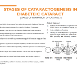 Diabetic Cataract Infograph