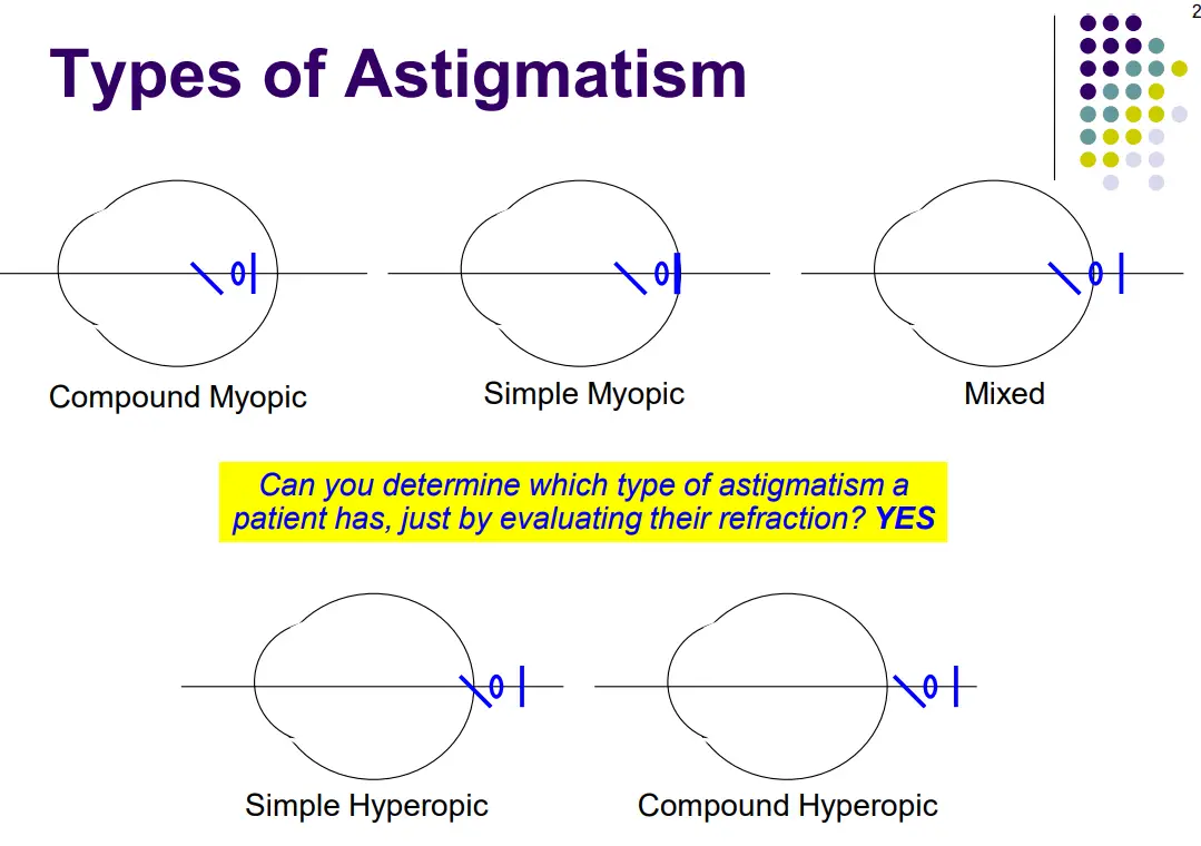 What is Mixed Astigmatism?