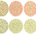 What do you See? Colour Vision test,Forms of Color Vision Deficiency 9 color vision test