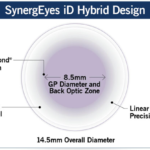 (EDOF)Extended Depth-of-Focus Contact Lenses