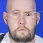 Is Whole Eye Transplant Possible? A Groundbreaking Achievement in Eye Care 12 is whole eye transplant possible