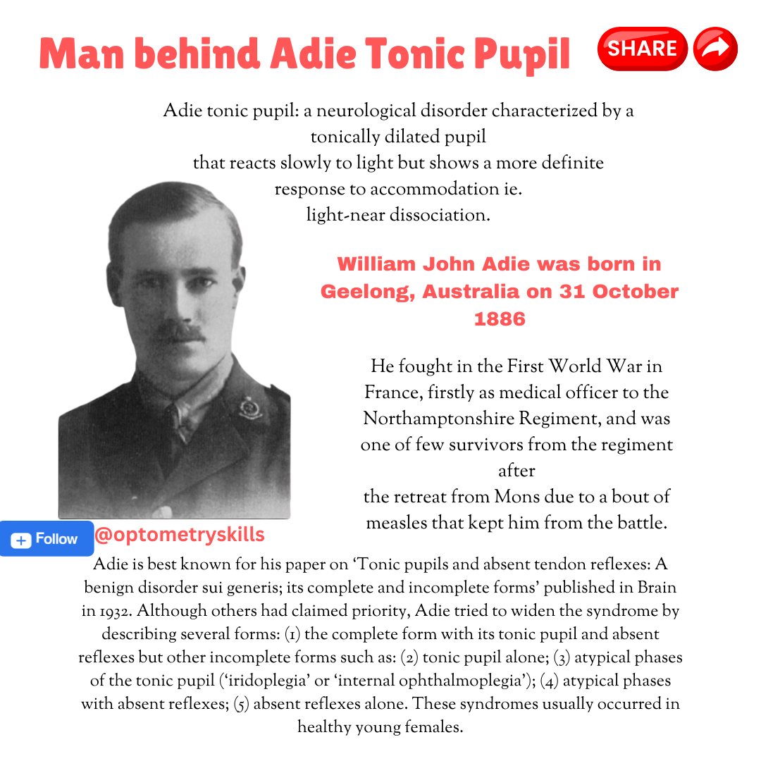 William John Adie-The Neurologist Behind Adie’s Tonic Pupil