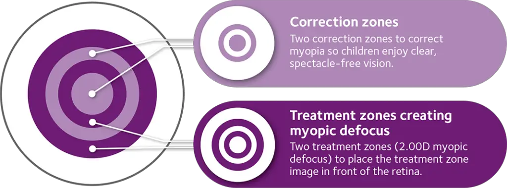 MiSight Lenses