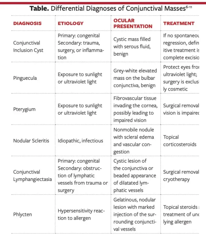 Differential Diagnoses of Conjunctival Masses