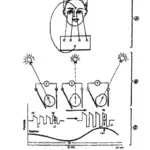 electroretinogram