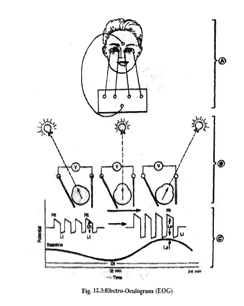 electroretinogram