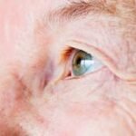 older patient eyes